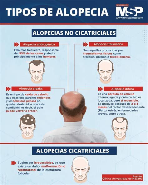 Infografía detallando las diferentes causas de la alopecia, incluyendo factores genéticos, hormonales, estrés, nutrición y peinados.