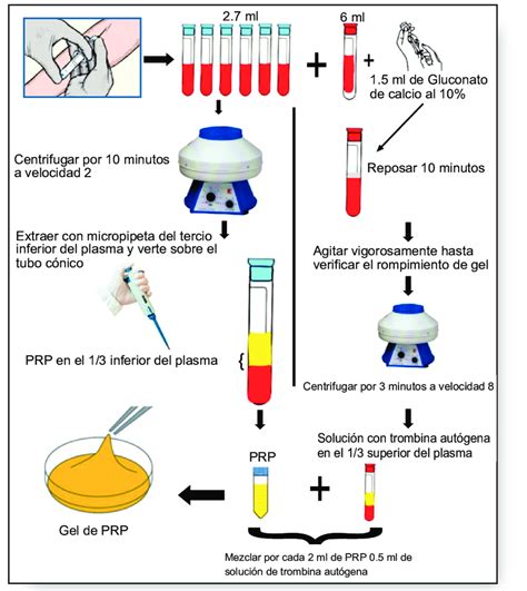 Esquema del procedimiento de extracción y aplicación de Plasma Rico en Plaquetas (PRP) para el tratamiento capilar.