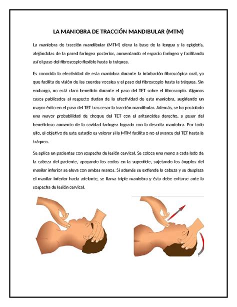 Tracción de la mandíbula