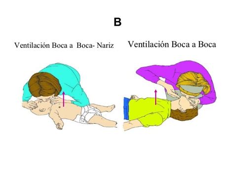 Ventilación boca-boca y nariz en el lactante