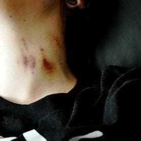 Maquillaje aplicado en el cuello para disimular un chupetón