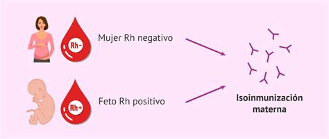 Ilustración de una inyección de RhoGAM para la prevención de la incompatibilidad Rh
