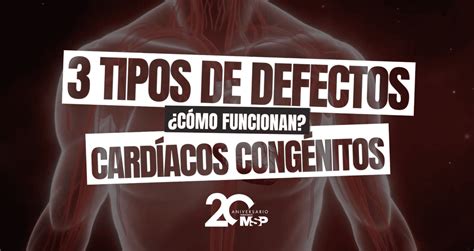 infografía con los tipos más comunes de defectos cardíacos en el síndrome de deleción 22q11.2