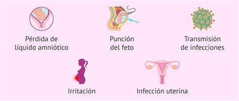 diagrama del procedimiento de amniocentesis y sus posibles riesgos