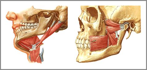 diagrama mostrando los músculos y huesos de la boca y cómo la succión del chupete puede afectarlos
