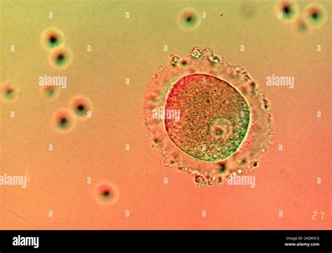 Micrografía electrónica de un cigoto mostrando la organización de los pronúcleos y restos de axonemas espermáticos.