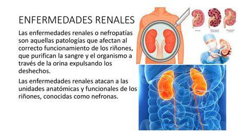 Infografía o esquema sobre las enfermedades renales pediátricas