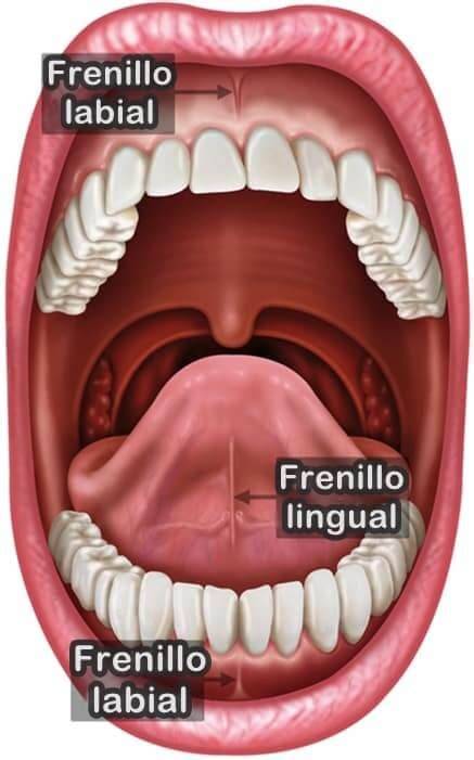 Diagrama que muestra la anatomía del frenillo sublingual y un frenillo lingual corto