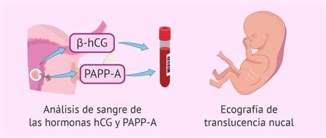 Infografía explicando los componentes del Triple Screening: edad materna, marcadores ecográficos y marcadores bioquímicos