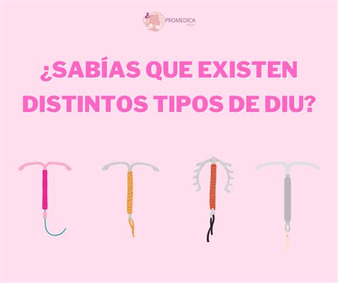 Diagrama de los tipos de DIU y su inserción en el útero