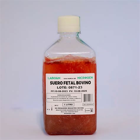 Esquema del proceso de obtención y purificación del suero fetal bovino