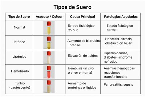 Tabla comparativa de diferentes tipos de suero fetal bovino según su aplicación