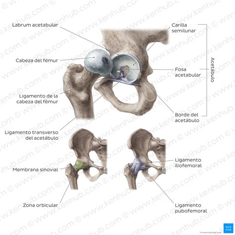 Diagrama de la articulación de la cadera, mostrando una cadera normal y una cadera con displasia evolutiva de cadera (DDC)