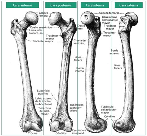 Diagrama comparativo de un fémur normal y un fémur con la forma de 