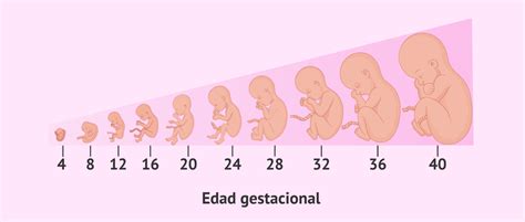Gráfico que ilustra la correlación entre la edad gestacional al nacer y el riesgo de complicaciones a largo plazo.