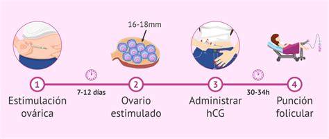 Esquema: Visualización de la estimulación ovárica y el desarrollo de folículos.