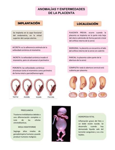 Diagrama o ilustración de anomalías uterinas y complicaciones placentarias