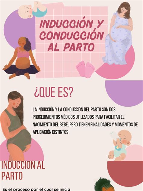 Esquema visual de los diferentes métodos de inducción del parto
