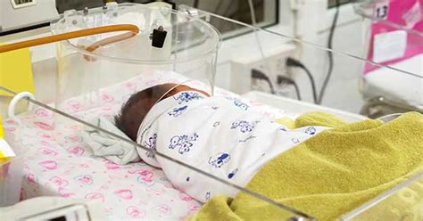 Monitores de apnea y bradicardia en UCIN