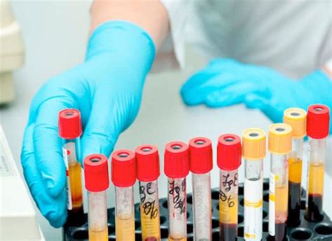 Esquema de examen ginecológico y pruebas de laboratorio