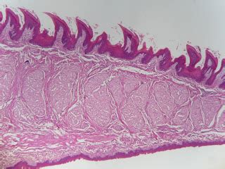 Micrografía: Corte transversal de la lengua mostrando fibras musculares entrecruzadas