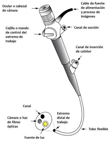 Representación esquemática de un endoscopio flexible y su funcionamiento