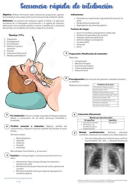 Secuencia de imágenes ilustrando la intubación esofágica durante una EDS