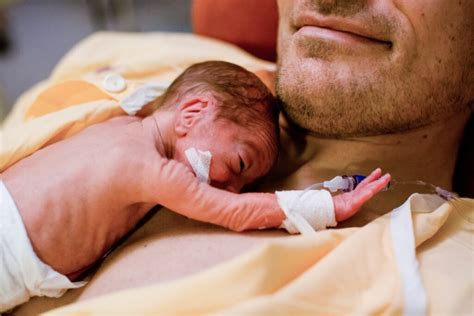 Fotografía de un bebé prematuro en contacto piel con piel con su madre o padre (método canguro)