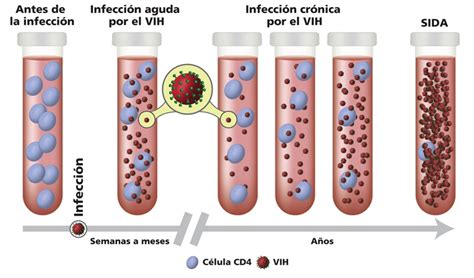 Esquema de las diferentes fases de la infección por COVID-19 y la aparición de anticuerpos