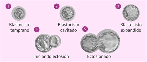 Diagrama mostrando los diferentes grados de expansión de un blastocisto