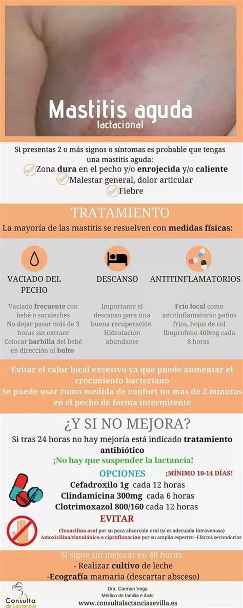 Imagen de una mujer con mastitis en el pecho