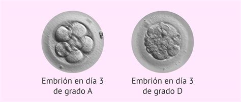 Comparativa de embriones en día 2, 3 y 5 de desarrollo