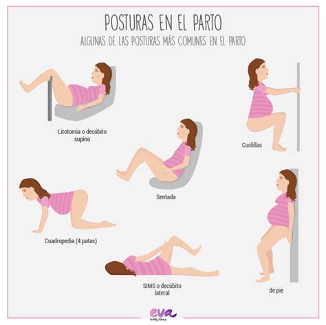 Comparación de posturas de parto, mostrando litotomía y posturas verticales