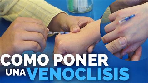 Punción en el dorso de la mano con aguja