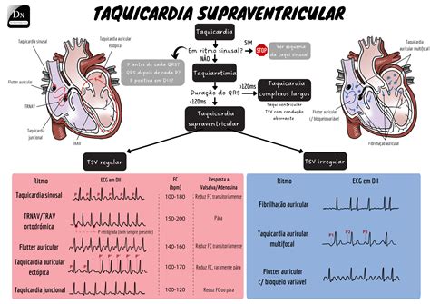 Diagrama que ilustra los diferentes tipos de taquicardias supraventriculares en pediatría, incluyendo TRAV y TRNAV.