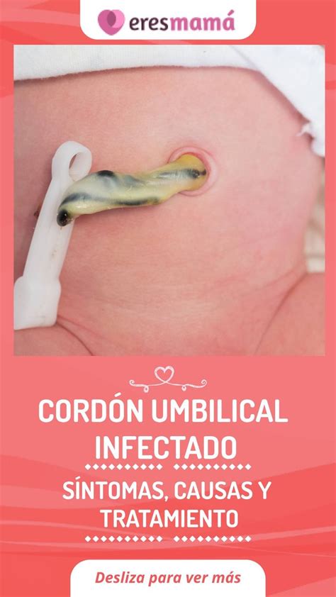 Síntomas de infección del cordón umbilical