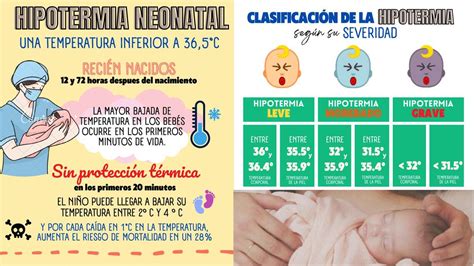Dispositivo de hipotermia neonatal en uso con un recién nacido