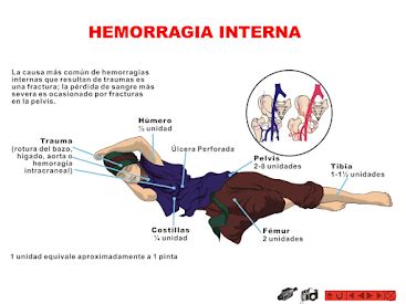 Diagrama mostrando las posibles complicaciones del DVE, como hemorragia y malposición