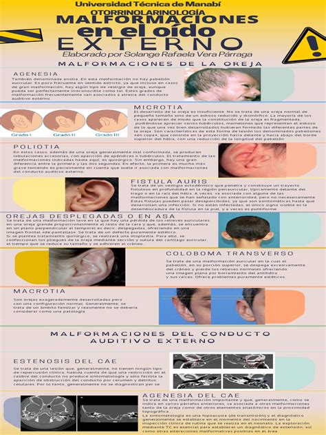 Ilustración de malformaciones de oído externo asociadas a microsomía hemifacial