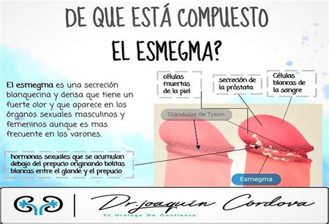 Esquema de la anatomía del pene con acumulación de esmegma