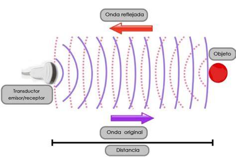 Esquema de cómo funciona una ecografía obstétrica con transductor, ondas sonoras y monitor