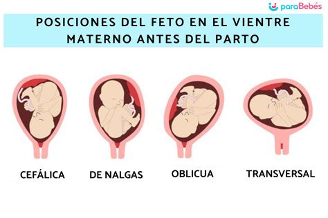 Diagrama de un feto en posición transversal