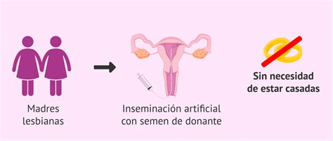 Esquema de la Inseminación Artificial con Donante
