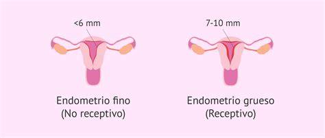 Esquema comparativo del endometrio receptivo y no receptivo visible en ecografía