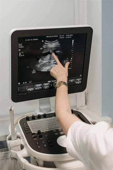 Matrona en un hospital observando una ecografía con expresión reflexiva