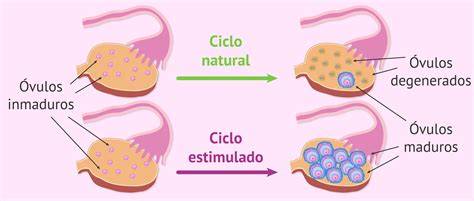 Infografía comparativa: ciclo natural frente a ciclo programado con anticonceptivos para FIV