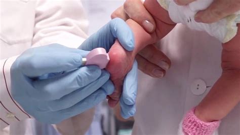 Foto de una mano de un profesional sanitario realizando la punción en el talón de un recién nacido para la toma de muestra en papel de filtro.