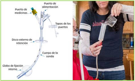 Esquema de la técnica de alimentación con jeringa-dedo