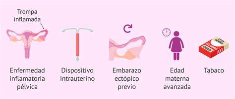 Diagrama de los factores de riesgo para el embarazo ectópico