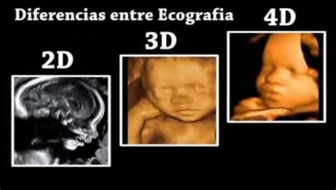 Infografía sobre los tipos de ecografía: 2D, 3D, 4D y Doppler